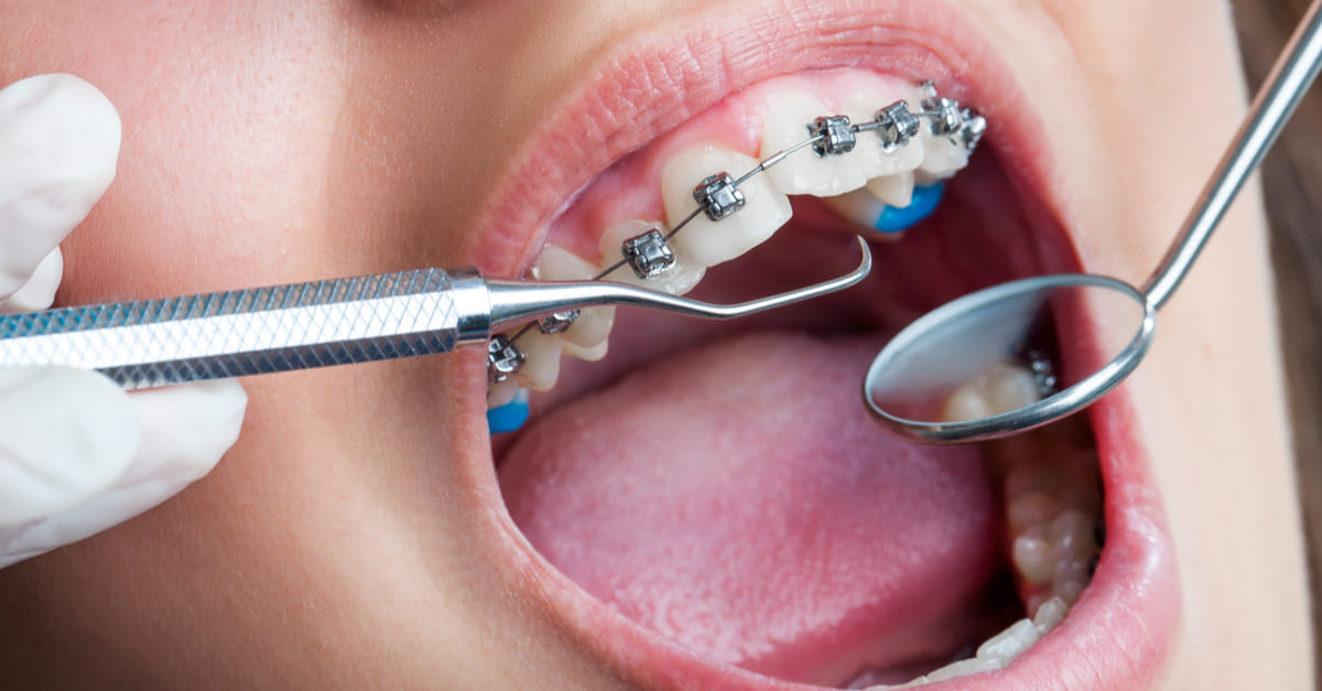 ez6lg8d76w5gwctz03q6g2qd3m53